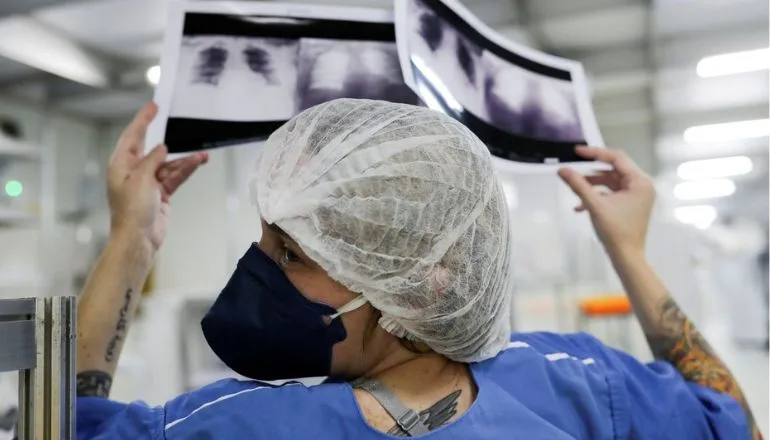 Câncer de pulmão: 15% dos casos acontecem em não fumantes