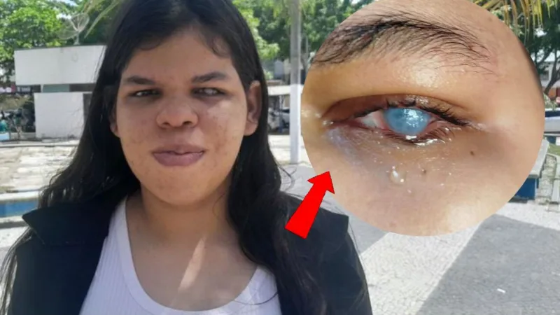 Teixeira: família lança rifa de moto para custear cirurgia de adolescente para voltar a enxergar Teixeira: família lança rifa de moto para custear cirurgia de adolescente para voltar a enxergar